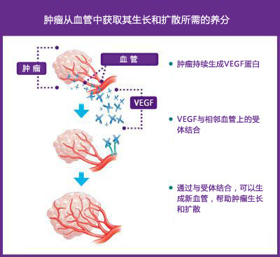 这种蛋白被称作vegf(血管内皮生长因子),肿瘤在整个生命周期中都会